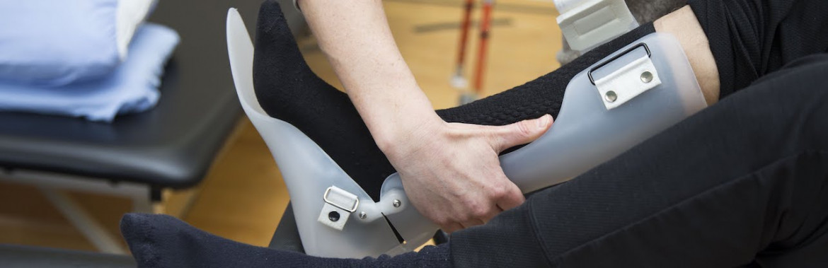 Orthotics, Prosthetics and Seating Clinics Island Health 