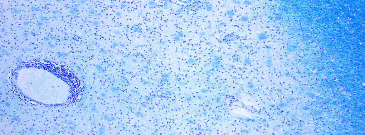 Multiple Sclerosis Clinic