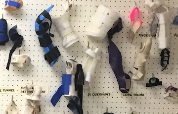 Prosthetics Services Victoria BC